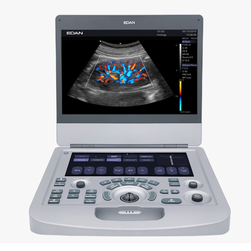 Ultrasound EDAN AX2 - AX3