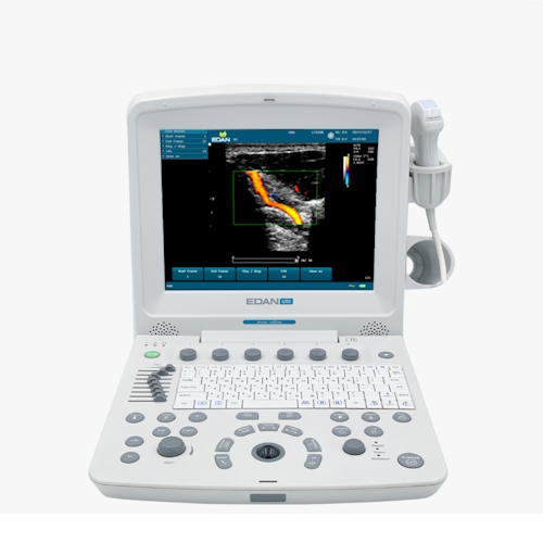 Ultrasound EDAN U50